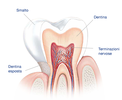 Ipersensibilità dentinale. Che cosa causa i denti sensibili? Ipersensibilità dentinale. Che cosa causa i denti sensibili?